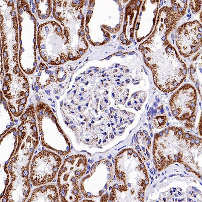 HADHA Recombinant Rabbit mAb (S-2345-8)