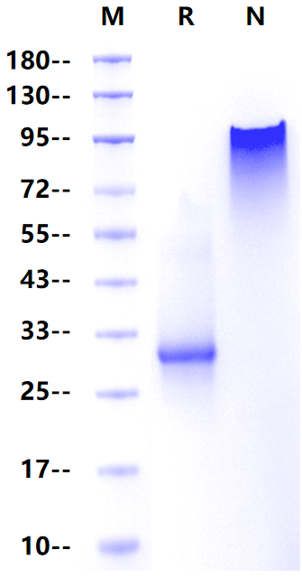 Noggin Protein, Human