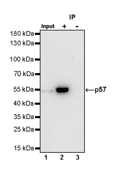 p57 Recombinant Rabbit mAb (SDT-191-79)