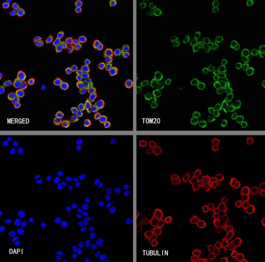 TOM20 Recombinant Rabbit mAb (S-M0015)