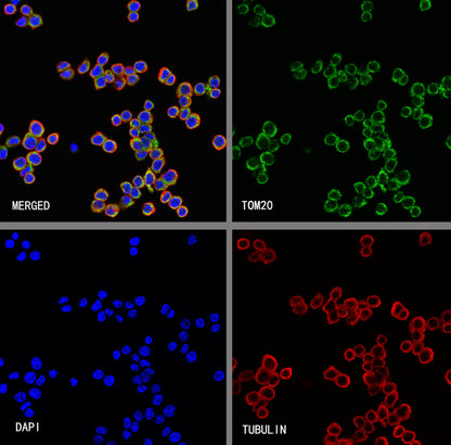 TOM20 Recombinant Rabbit mAb (S-M0015)