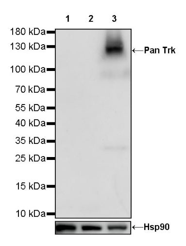Pan Trk Recombinant Rabbit mAb (SDT-400-39)