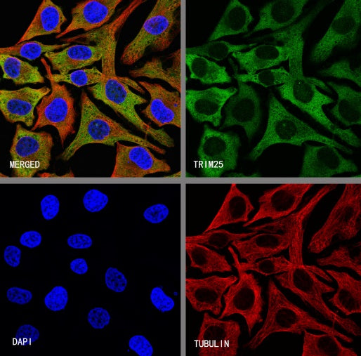 TRIM25 Recombinant Rabbit mAb (S-4069-59)