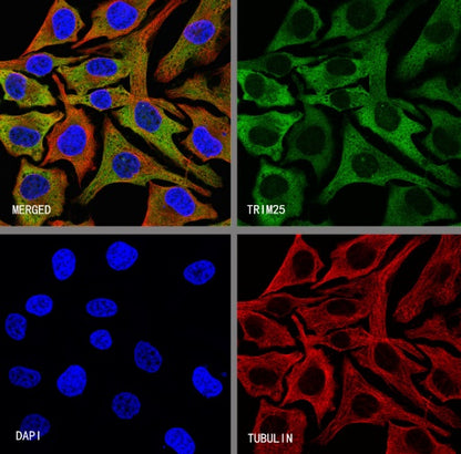TRIM25 Recombinant Rabbit mAb (S-4069-59)