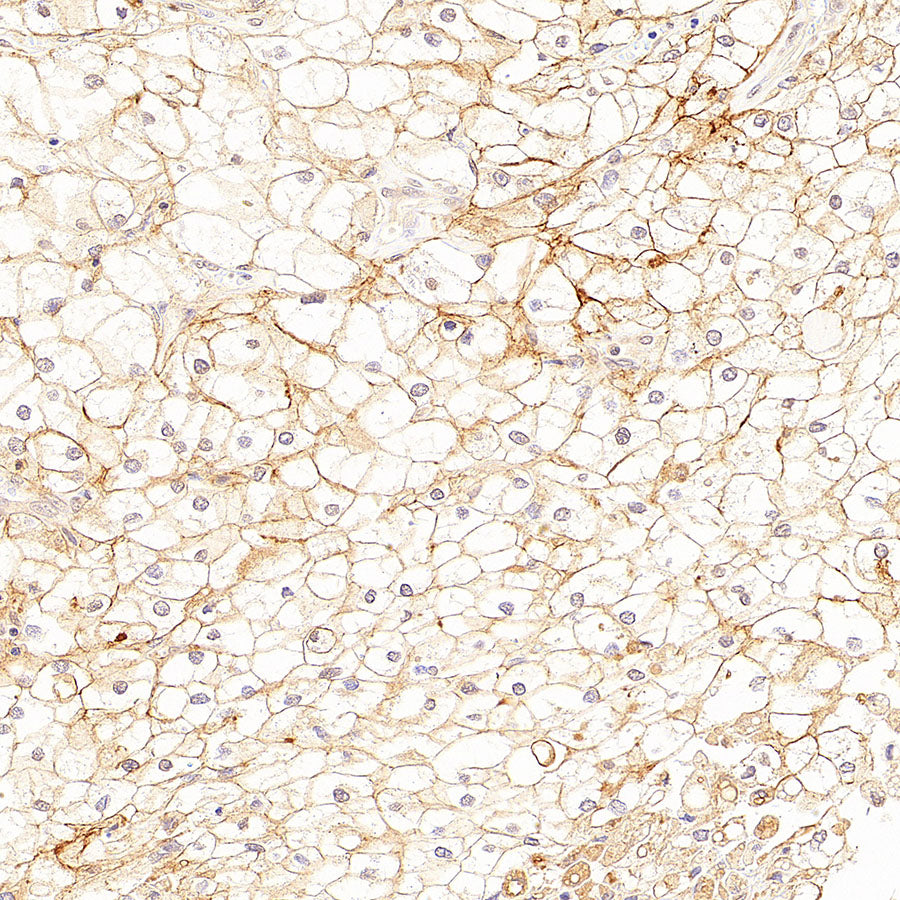 CA12 Rabbit Polyclonal Antibody