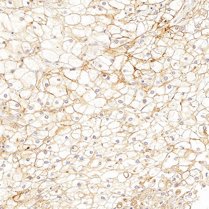 CA12 Rabbit Polyclonal Antibody