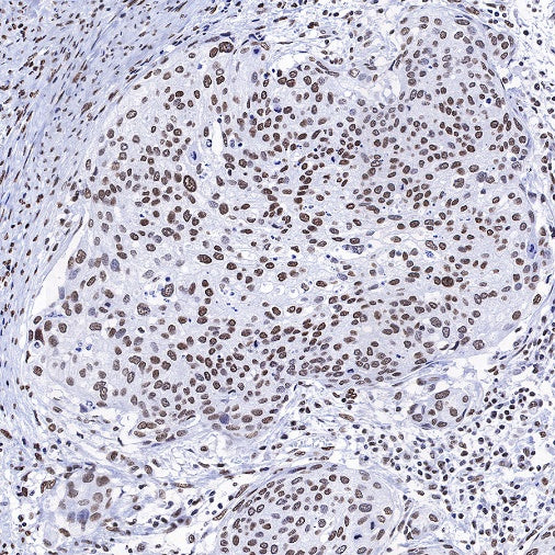 Histone H3 (acetyl K4 + K9 + K18) Rabbit polyclonal antibody