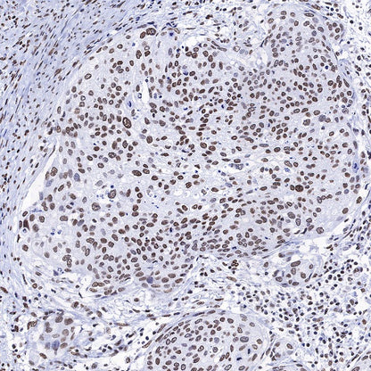 Histone H3 (acetyl K4 + K9 + K18) Rabbit polyclonal antibody