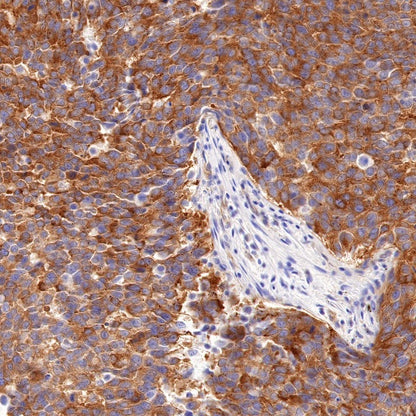 ATG9A Recombinant Rabbit mAb (S-1418-5)