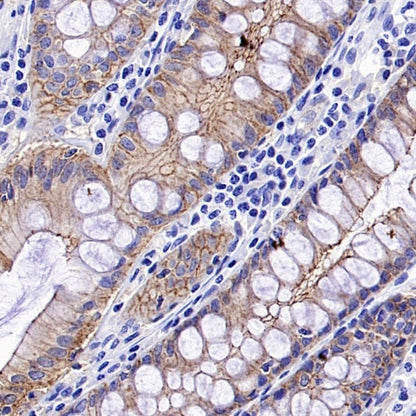 Occludin Recombinant Rabbit mAb (SDT-4588)
