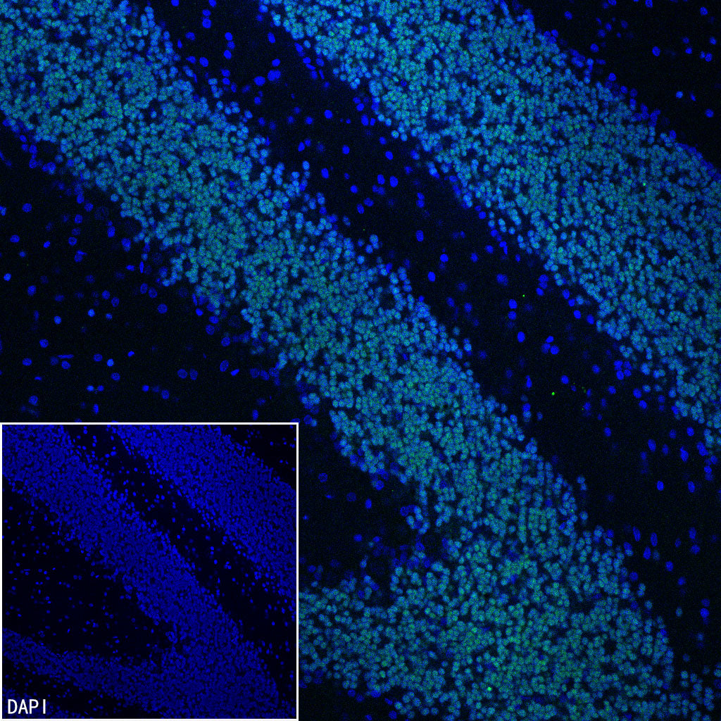 NeuroD1 Recombinant Rabbit mAb (SDT-3843-59)