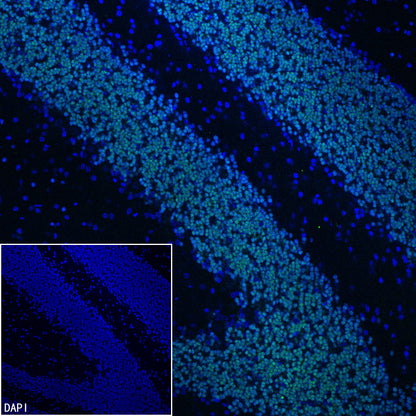 NeuroD1 Recombinant Rabbit mAb (SDT-3843-59)