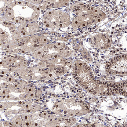 DCAF8 Recombinant Rabbit mAb (S-3483-11)