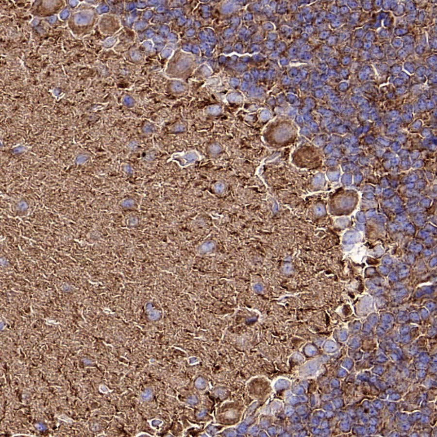 Beta III Tubulin Recombinant Rabbit mAb (S-5529)