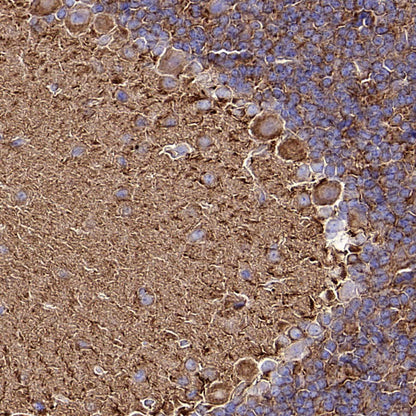 Beta III Tubulin Recombinant Rabbit mAb (S-5529)