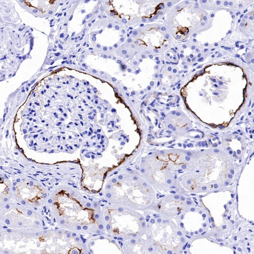 CD133 Recombinant Rabbit mAb(SDT-1295-22)