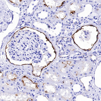 CD133 Recombinant Rabbit mAb(SDT-1295-22)