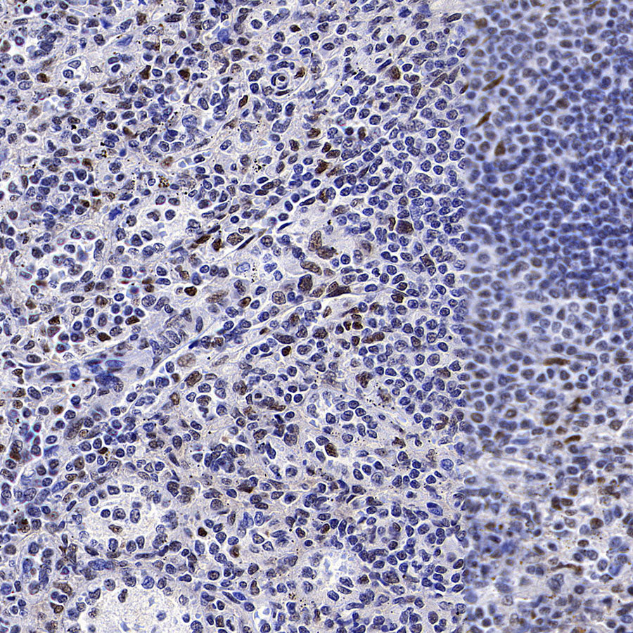 CoREST Recombinant Rabbit mAb (S-4401-8)