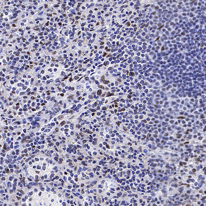 CoREST Recombinant Rabbit mAb (S-4401-8)