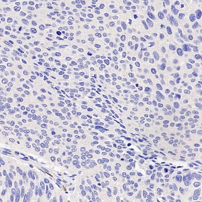CDKN2A/p16 INK4A Recombinant Mouse mAb (SDT-4677)