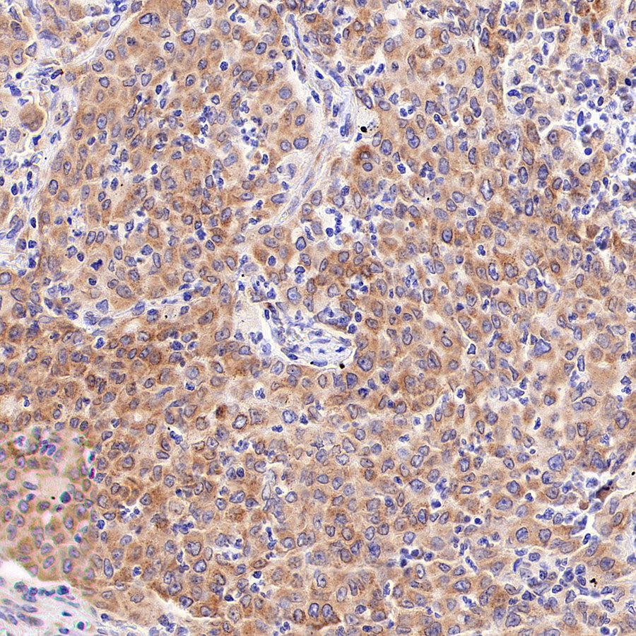 SPTLC1 Recombinant Rabbit mAb (S-6028)