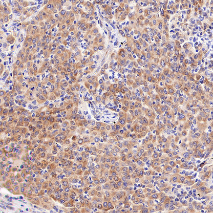 SPTLC1 Recombinant Rabbit mAb (S-6028)