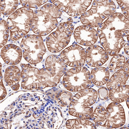 Hsp90 beta Recombinant Rabbit mAb (SDT-359-59)