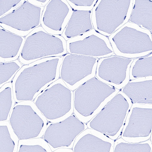 Cardiac Troponin I Recombinant Rabbit mAb (S-1352-15)