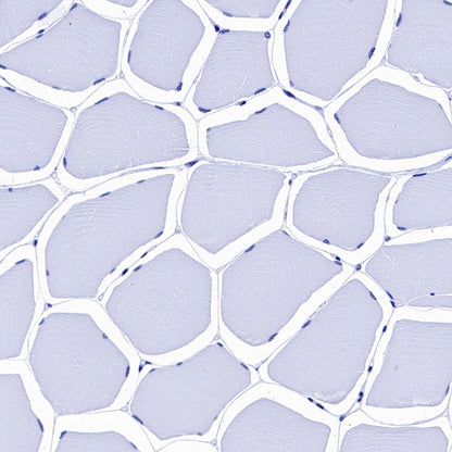 Cardiac Troponin I Recombinant Rabbit mAb (S-1352-15)