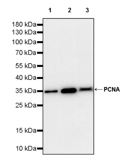 PCNA Recombinant Rabbit mAb (S-5313)