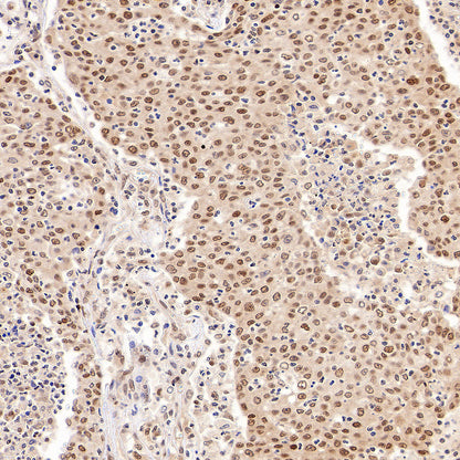 hnRNP A1 Recombinant Rabbit mAb
