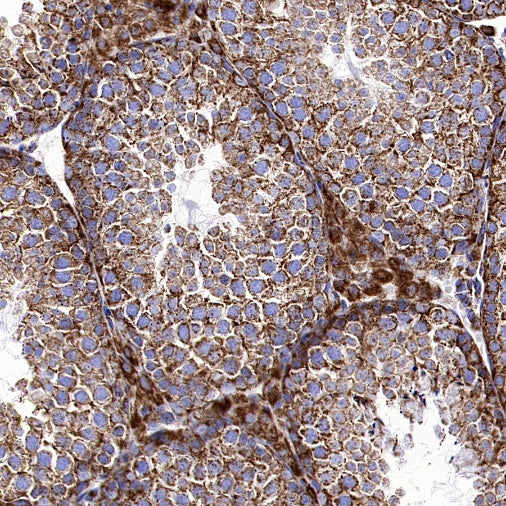 TOM20 Recombinant Rabbit mAb (SDT-2553-11)