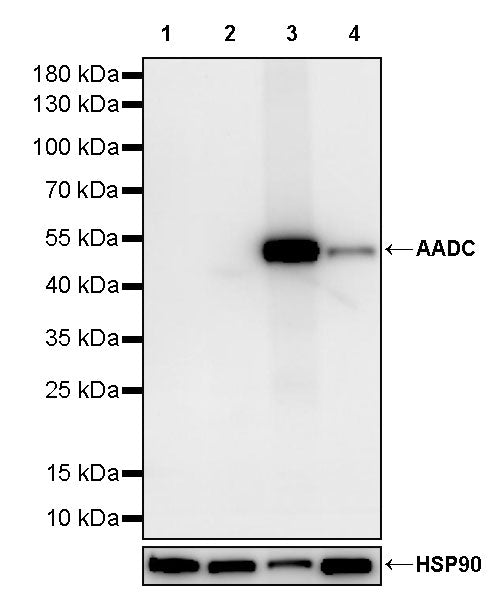 AADC Recombinant Rabbit mAb (S-3568-1)