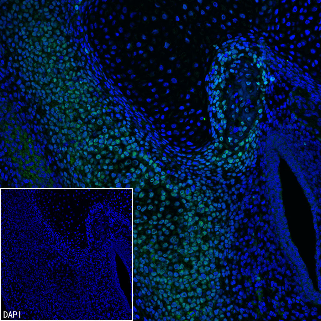 Sp7/Osterix Recombinant Rabbit mAb (S-4225-14)