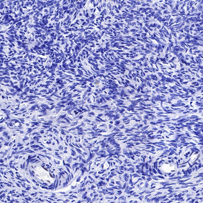 SOX17 Recombinant Rabbit mAb (SDT-1803-48)