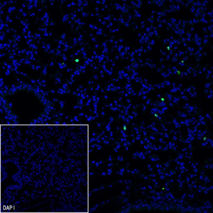 Olfm4 Recombinant Rabbit mAb (S-2748-67)