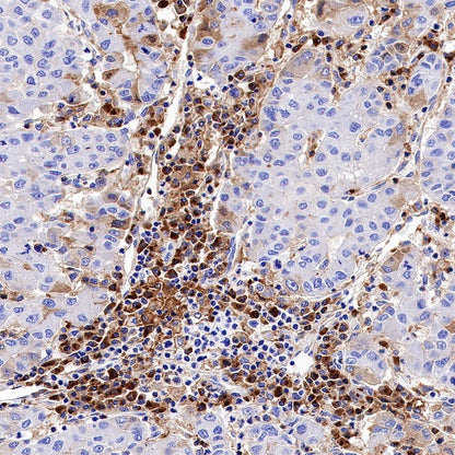 TIM-3 Recombinant Rabbit mAb (S-1450-21)