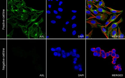 AXL Recombinant Rabbit mAb (S-2199-80)
