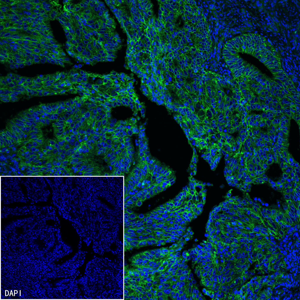 CD151 Recombinant Rabbit mAb (S-3235-104)
