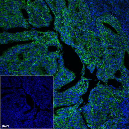 CD151 Recombinant Rabbit mAb (S-3235-104)