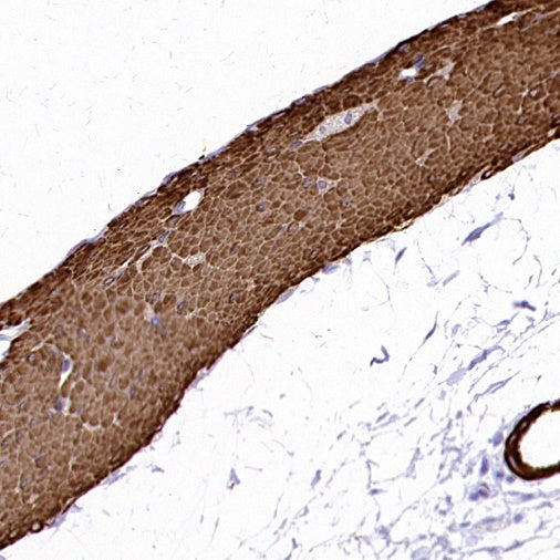alpha smooth muscle Actin (acetyl E3) + ACTG2 (acetyl E3) Recombiant Rabbit mAb (S-3355)