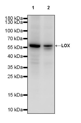 LOX Recombinant Rabbit mAb (S-1647-49)