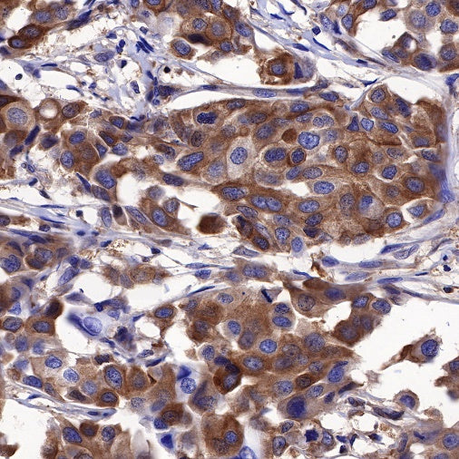 Calpastatin Recombinant Rabbit mAb (S-R184)