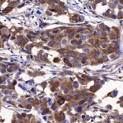 Calpastatin Recombinant Rabbit mAb (S-R184)