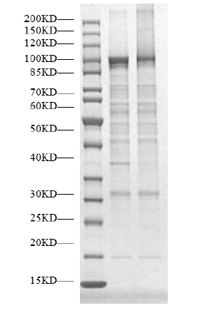 USP44 Protein