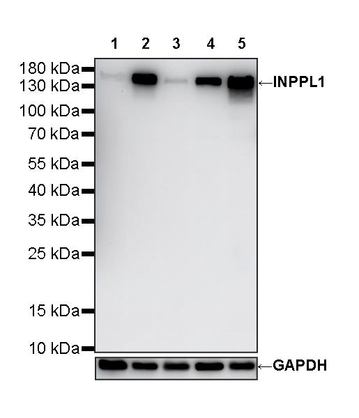 INPPL1 Recombinant Rabbit mAb (S-4567-47)