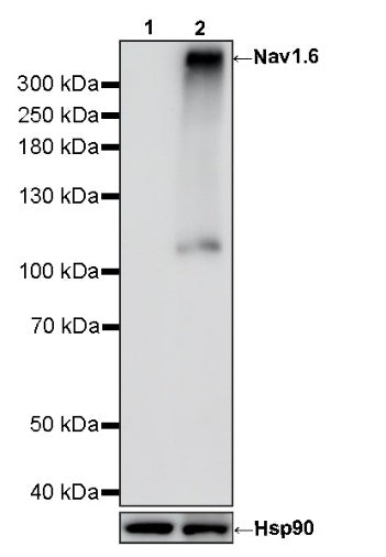 Nav1.6 Recombinant Rabbit mAb (S-4298-3)