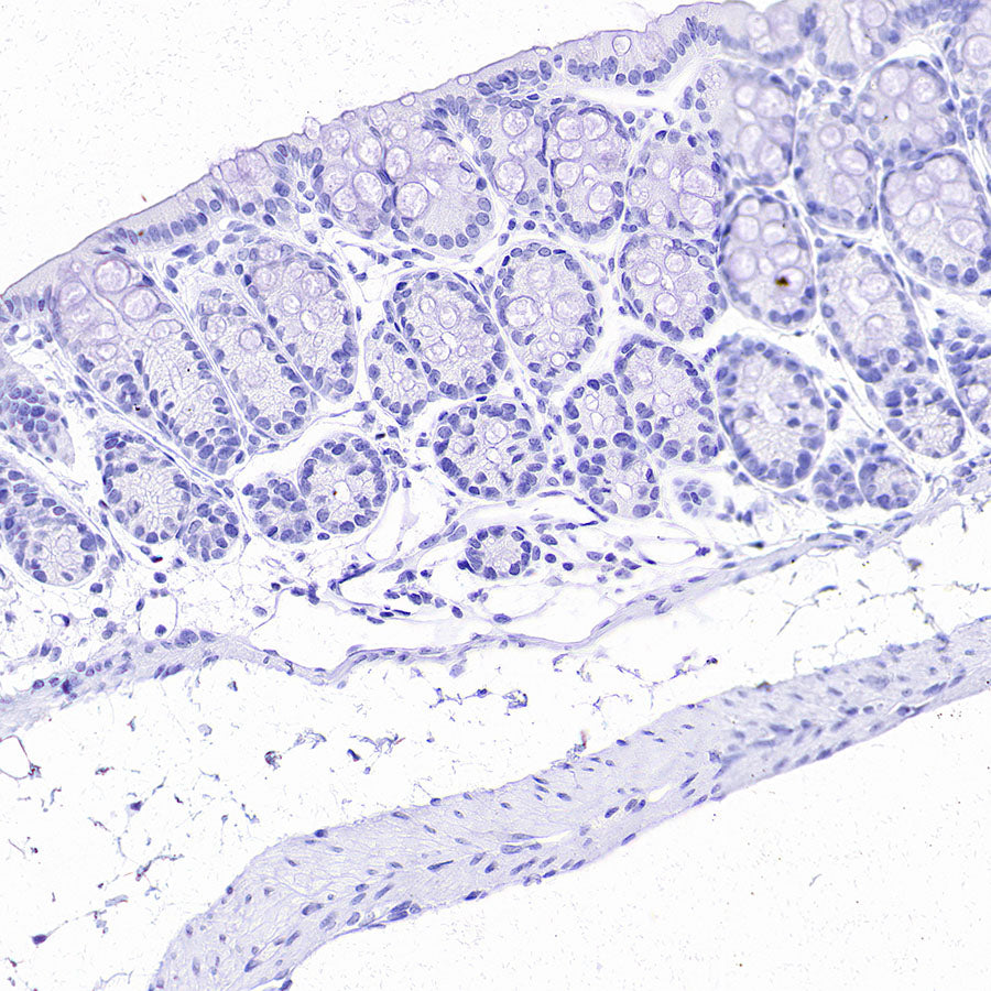 ALPI Recombinant Rabbit mAb (S-3768-104)