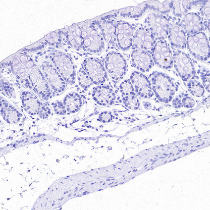 ALPI Recombinant Rabbit mAb (S-3768-104)