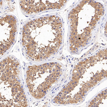 ALDH1A1 Rabbit Polyclonal Antibody